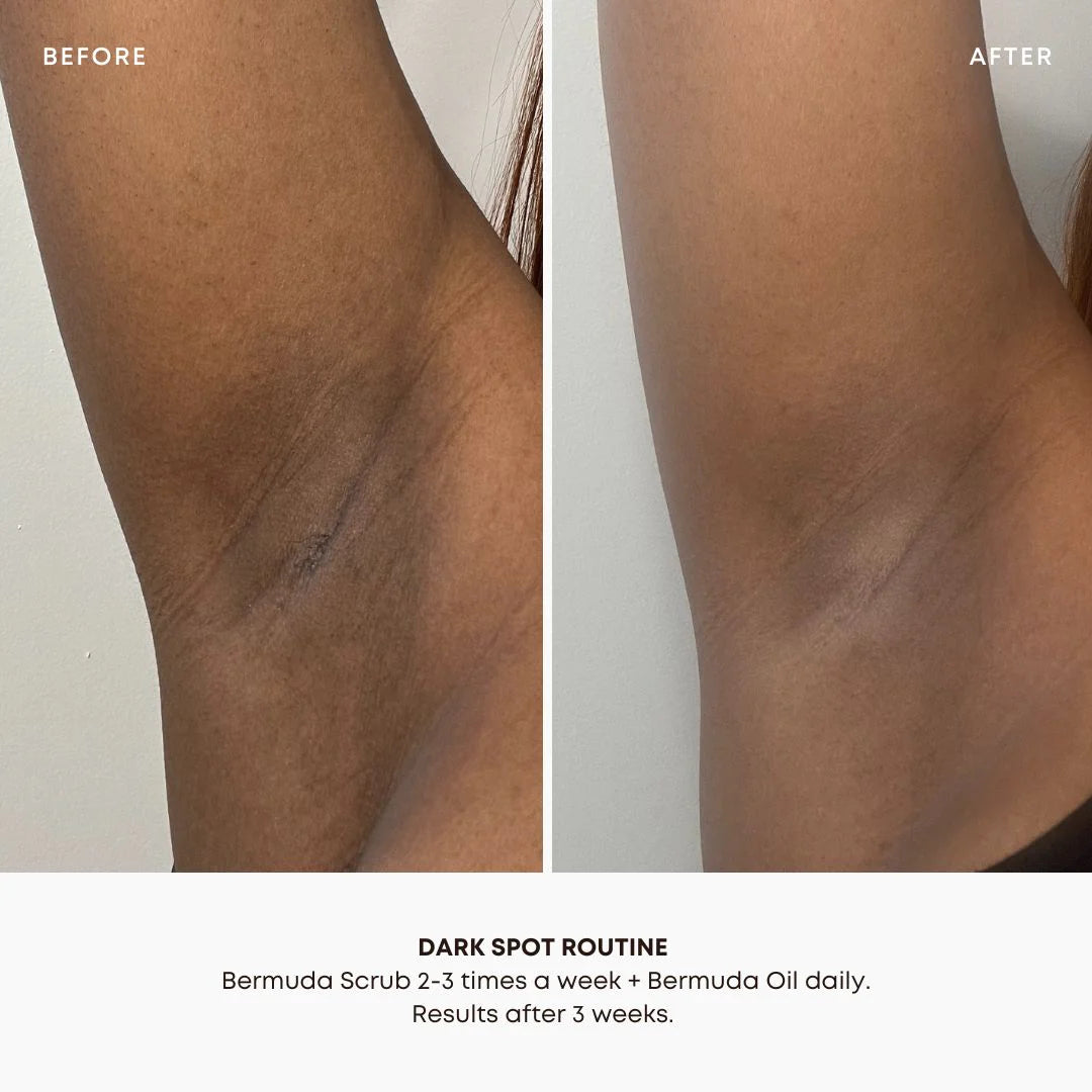 Bushbalm | Bermuda (1 fl. oz. / 30 mL)  Dark Spot Oil