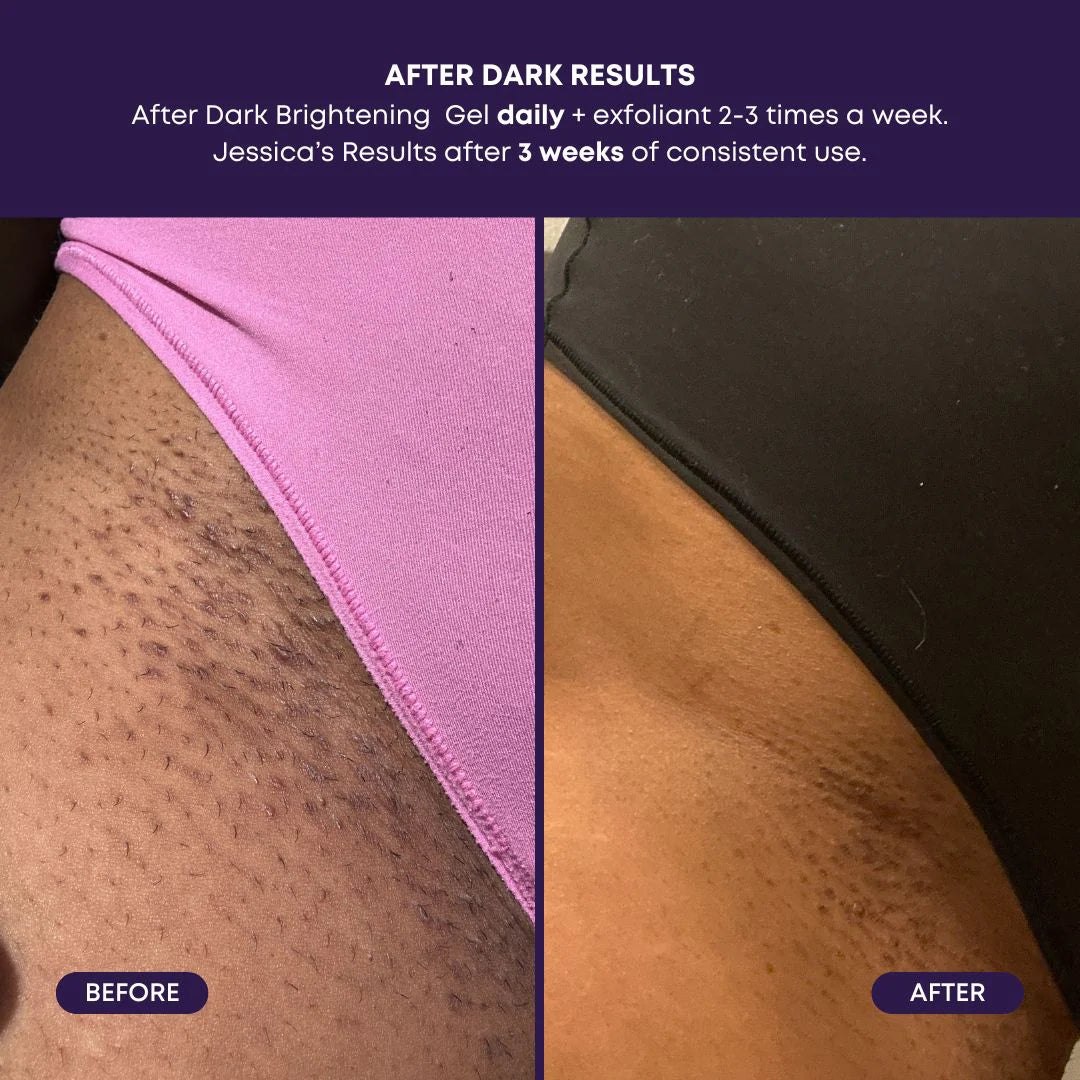 Bushbalm | After Dark Brightening Gel