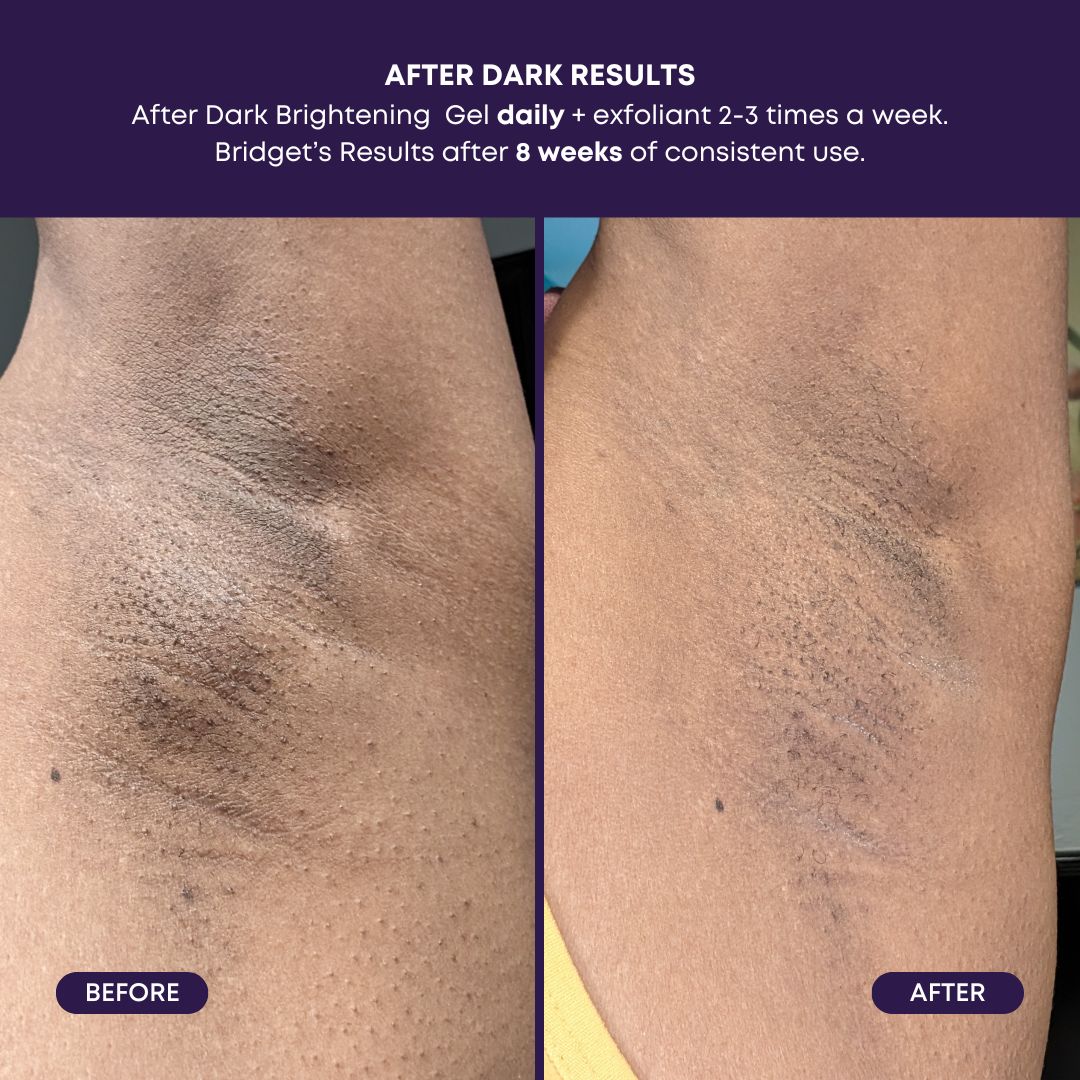 Bushbalm | After Dark Brightening Gel