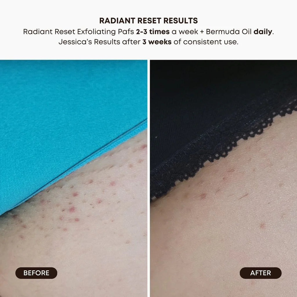 Bushbalm | Radiant Reset Exfoliating Toner Pads