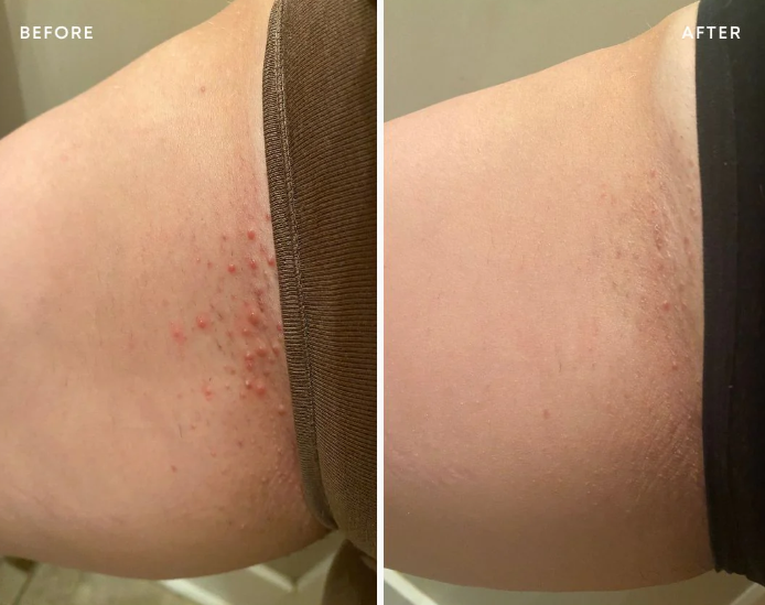 Bushbalm | Nude · 1 fl. oz. | 30 mL  Ingrown Hair + Pre-Post Wax Oil